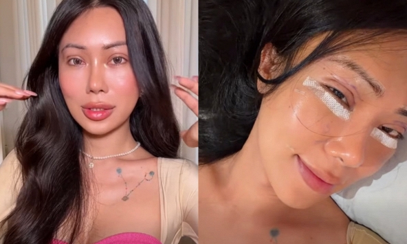  Mỹ nhân chuyển giới An Giang khóc lóc suy sụp sau khi tiêm mỡ toàn mặt 