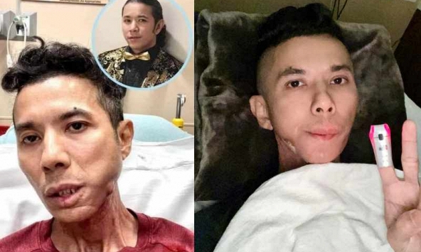 Chi phí điều trị bệnh của Kasim Hoàng Vũ bên Mỹ 'khủng' ra sao?