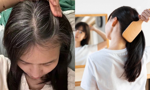 Nhiều người chưa 30 tuổi đã bạc tóc: 3 nhóm người dễ có tóc bạc nhất và 3 cách đơn giản giúp tóc đen lâu hơn