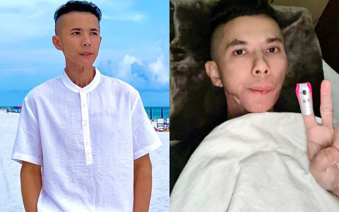 Những ngày cuối đời của ca sĩ Kasim Hoàng Vũ: Khuôn mặt biến dạng do bệnh u xương hàm, bế tắc vì chi phí chữa trị hàng tỷ đồng