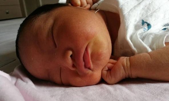 Trẻ sơ sinh có 3 đặc điểm “càng xấu” lại càng chứng tỏ em bé phát triển tốt trong bụng mẹ