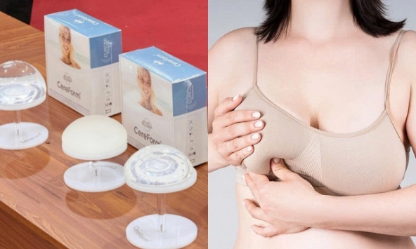 Tái sinh vòng 1 sa trễ với túi ngực Cereform thế hệ mới