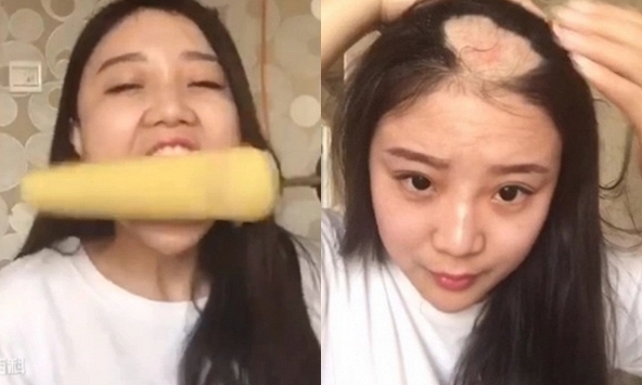 Cuộc sống sang chảnh hiện tại của “cô gái bị hói một mảng đầu vì ăn ngô bằng khoan” 10 năm trước