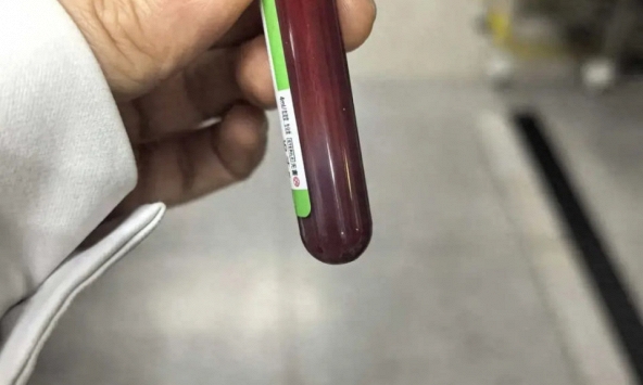 Mẹ bầu nghiện ăn gà rán, hamburger, tăng 5kg chỉ sau 1 tuần, cả mẹ lẫn con phải đi cấp cứu