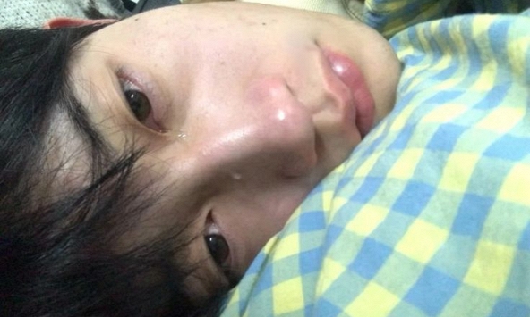 Bác sĩ nhắc nhở 6 triệu chứng phổ biến nhất của ung thư ruột: Tiếc là rất nhiều người bỏ qua, tưởng là… 'ốm vặt'