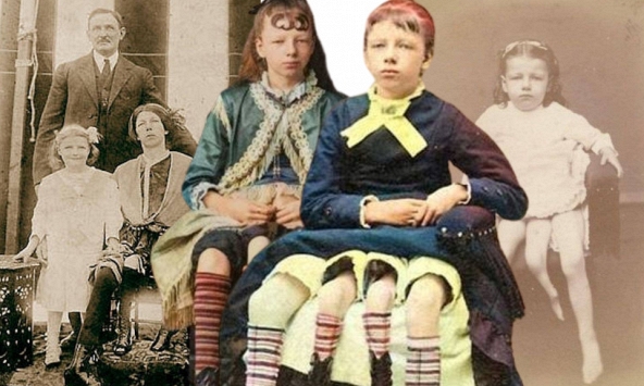 Cô gái 4 chân, 2 'vùng kín': 13 tuổi thành đại minh tinh với cuộc hôn nhân bí ẩn