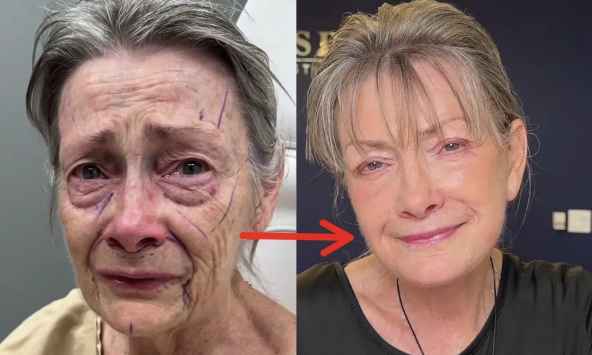 Bác sĩ thẩm mỹ được đặt lịch ồ ạt tới tận... 50 năm sau nhờ màn cải lão hoàn đồng thành công cho khách hàng