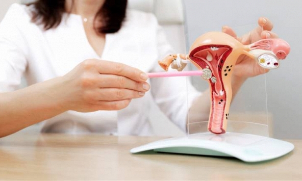 Phẫu thuật buồng trứng, tử cung có gây vô sinh? BS cảnh báo: Phụ nữ từng làm '2 loại phẫu thuật này' nên sớm bảo tồn khả năng sinh sản