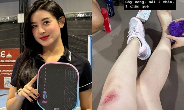 Á hậu Huyền My gặp tai nạn khi chơi pickleball