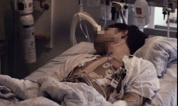 Nam sinh 18 tuổi tử vong vì ung thư đại trực tràng, bác sĩ: Nguyên nhân là món thịt thơm lừng, trẻ em Việt rất thích