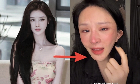 Xôn xao vụ cô gái hút mỡ hết 70 triệu nhận lại mặt biến dạng, nửa đêm “phốt' bác sĩ thẩm mỹ: Phía bác sĩ nói gì?