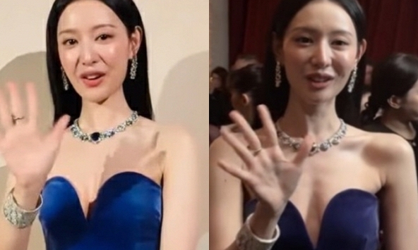 Kim Ji Won gặp vấn đề sức khỏe nghiêm trọng? 