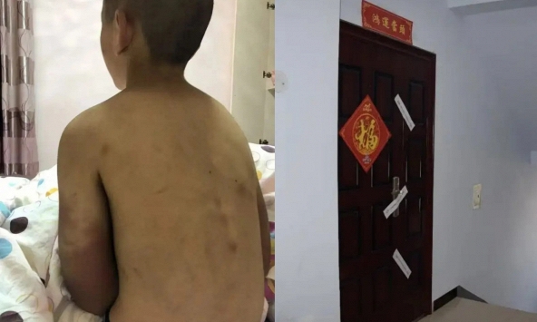 Bi kịch của cậu bé 14 tuổi phải mặc tã