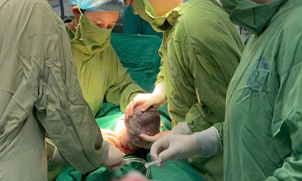 Em bé sinh ra với 'đôi cánh nhỏ' trên lưng: Mẹ ơi! Con đến với mẹ rồi đây!