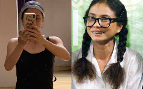 Nữ NSƯT đóng vai Cô Gái Xấu Xí bị 28 vết xẹo trên mặt vì tai nạn, cuộc sống hiện tại ra sao? 