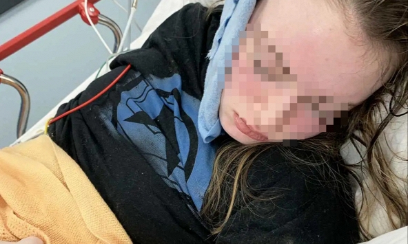 Sự thật về cơn đau đầu do học hành của thiếu nữ 18 tuổi: 'KHÔNG PHẢI đột quỵ, đến muộn 30 phút là tử vong'