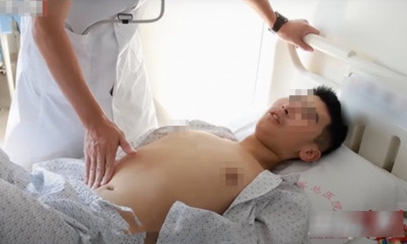 Nam sinh 15 tuổi nôn ra máu, nội soi thấy 'sỏi dạ dày': 80% các trường hợp ung thư dạ dày có liên quan