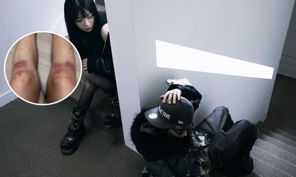  Nữ ca sĩ yêu lại bạn trai cũ từng đánh cô bầm dập toàn thân: “Tôi không kiện anh ấy nữa”