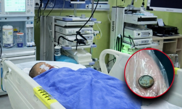 Bé trai 3 tuổi nuốt phải pin cúc áo, mẹ cho uống ngay 1 thìa gia vị, đến bệnh viện bác sĩ khen: 'Giỏi lắm'