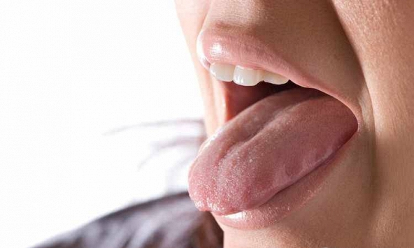 Cứ nghĩ nhiệt miệng, người đàn ông 41 tuổi 'mất' nửa chiếc lưỡi sau 2 tháng