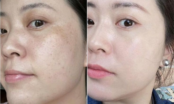 Làm 6 việc này trước khi đi ngủ, làn da của tôi như “tái sinh” về năm 20