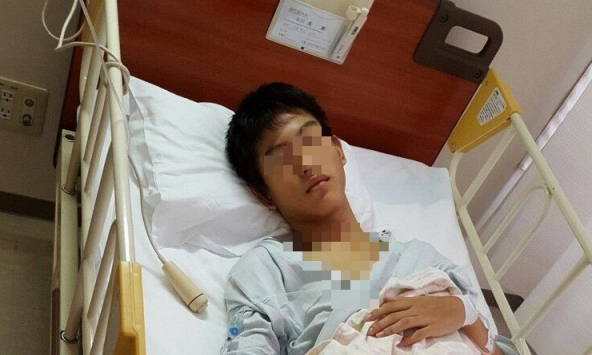 Nam sinh 17 tuổi khám nghẹt mũi lộ ra khối u 'ăn' hộp sọ, bác sĩ nhắc: 'Có 3 dấu hiệu phải đến bệnh viện ngay'