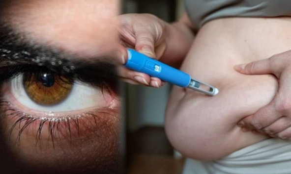 Giảm 10kg sau 4 tháng tiêm “bút giảm cân”, người đàn ông bàng hoàng khi tỉnh dậy bị đột quỵ mắt, một bên không nhìn thấy gì