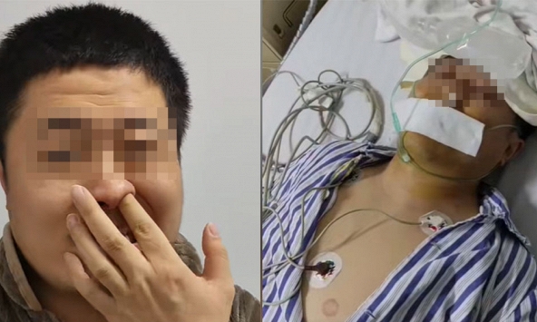 Người đàn ông bị tổn thương não vĩnh viễn vì xì mũi quá mạnh: Bạn có đang làm việc này đúng cách?