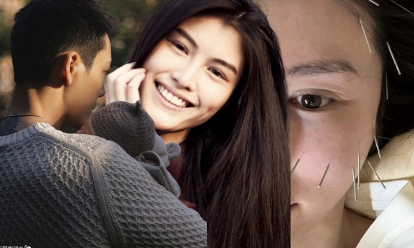 Vợ tổng tài hot nhất Trung Quốc ghim hàng chục cây kim lên mặt để ngăn xệ sau sinh