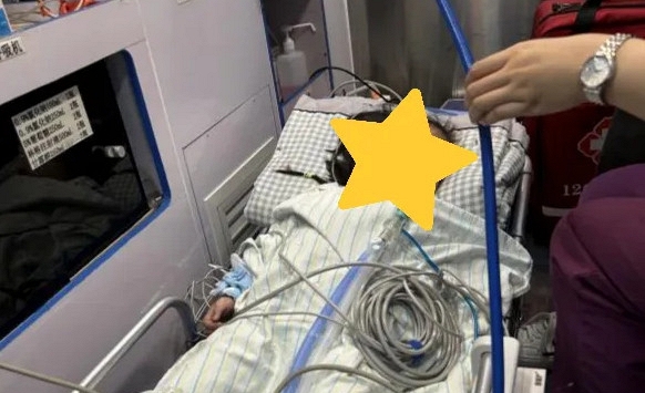 Bé trai 2 tuổi ngừng tim, phù não vì 1 thứ 'không chân' trú ngụ trong phế quản