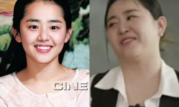 Moon Geun Young bị hoại tử và phát tướng mất kiểm soát do bệnh quái ác, bỏ lỡ giai đoạn vàng để điều trị 