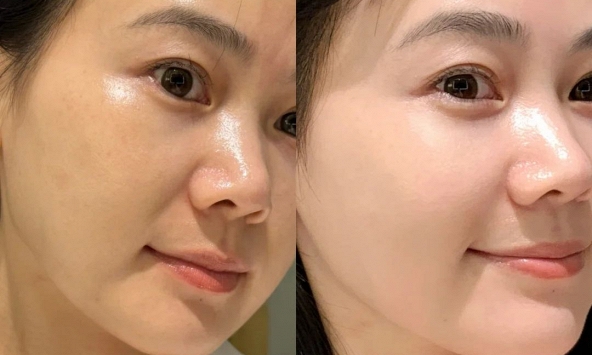 Tôi 'bơm nước' cho da căng mọng, 'hồi sinh' da khô sần chỉ với 5 việc làm này