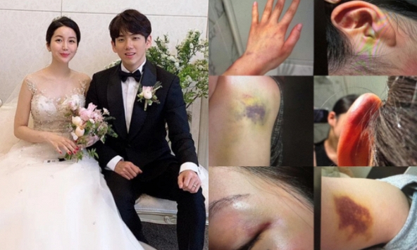 Anh trai Jisoo (BLACKPINK) lại trở thành tâm điểm phẫn nộ: Bị tố bạo hành gia đình, bắt vợ phải quỳ gối xin tha?