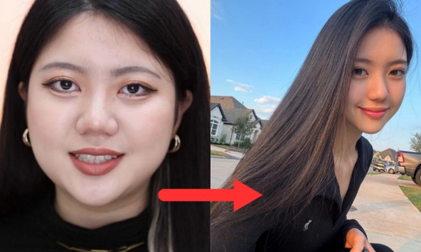 Sức mạnh của việc giảm 12kg: Cô gái thành nữ thần trong phút mốt, mặt gọn đi phân nửa nhờ 1 công thức duy nhất