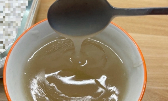 Thiếu nữ 16 tuổi qua đời vì suy thận, người mẹ tiết lộ bí mật liên quan đến điều gần như cô gái nào cũng 'ám ảnh'