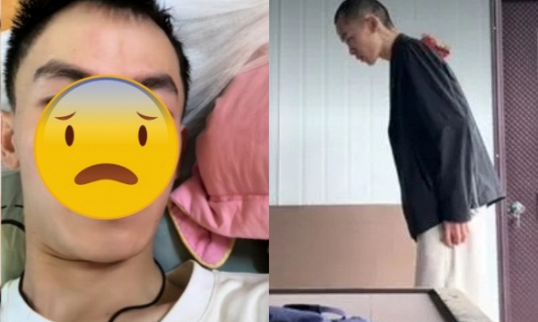 Nam diễn viên sinh năm 1999 bị đột quỵ nhồi máu não vì thức khuya, tình trạng liệt mặt và chỉ còn 30 kg hiện tại gây xót xa