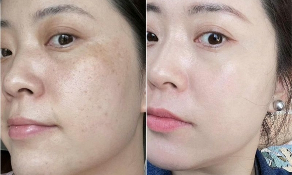 Làm 4 việc này khi thức giấc, làn da tôi “tươi mới” lúc nào không hay