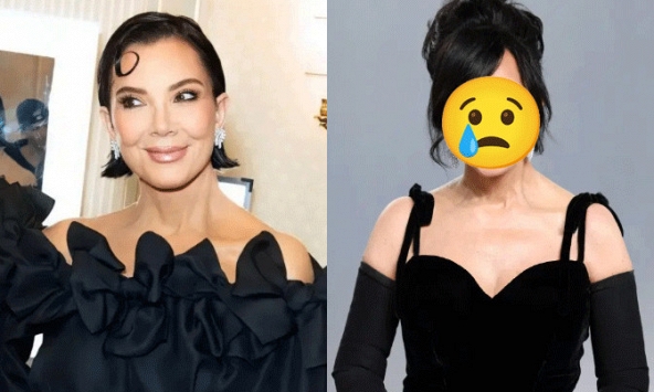 Bà trùm Kardashian chi 2,6 tỷ 'cải lão hoàn đồng', ngờ đâu sau 1 năm phải nhận kết đắng 