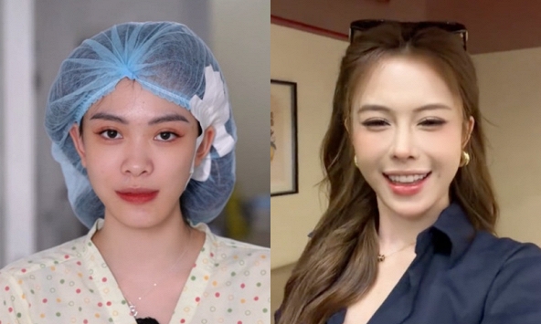 Hà Môi “đắp tiền lên mặt” để sửa những gì? Còn chiếc mũi “đang hếch dần và méo” giờ ra sao?