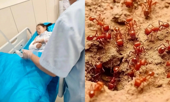 Bé 4 tuổi phát ban, tím tái, thở gấp sau khi bị kiến lửa đốt: Người mẹ làm ngay 4 việc này, bác sĩ cũng phải khen 'làm rất tốt'