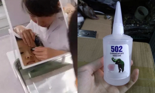 Cậu bé 3 tuổi bắt chước bà nhưng nhỏ nhầm keo 502 vào mắt: Mẹ sơ cứu trong 15 phút, bác sĩ nói 'không cần điều trị nữa'
