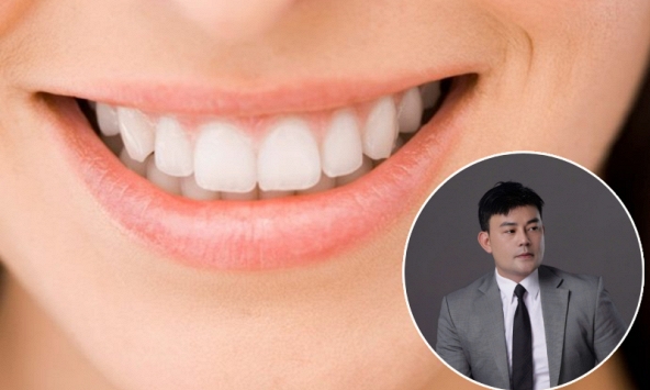 CEO nha khoa tư vấn những sai lầm đắt giá khi làm răng sứ