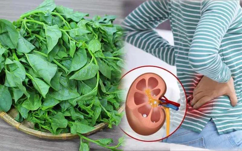 Loại rau có vị nhớt khó ăn nhưng lại được coi là 'nữ hoàng' giải nhiệt mùa hè: Có 5 nhóm người tốt nhất đừng ăn nhiều