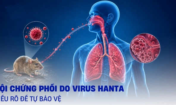 Virus Hanta gây tử vong tới 50%, chuyển biến bệnh cực nhanh: Bệnh viện Bạch Mai cùng các bác sĩ đầu ngành đồng loạt ra cảnh báo