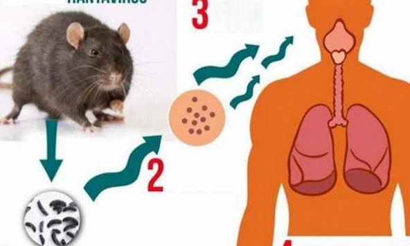 Khó khăn lớn nhất của bệnh do virus Hanta: Dễ nhầm với bệnh cúm thông thường, có thể gây tử vong nhanh chóng
