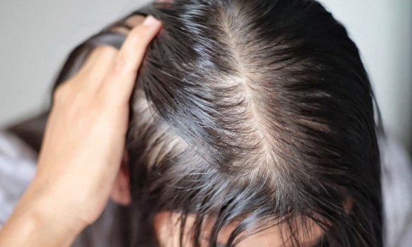 Lời khuyên cho những người hay bị rụng tóc