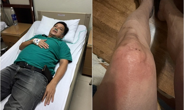 NSƯT Chí Trung mắc bệnh lạ