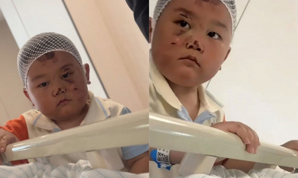 Bé trai 3 tuổi túc trực chăm mẹ sau tai nạn nghiêm trọng: Mặc dù chính bé bị nhiều vết thương đau đớn nhưng vẫn theo sát mẹ không rời