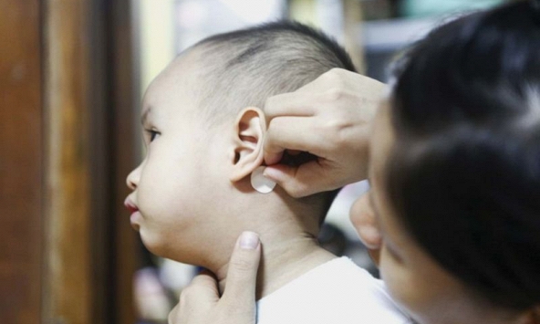 Miếng dán chống say xe - Vật bất ly thân trong túi mỗi gia đình đi du lịch lại đang âm thầm đe dọa trẻ nhỏ