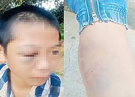 Quyết định của thầy hiệu trưởng trong vụ bé trai nghi bị bạo hành khi sống cùng bố và mẹ kế